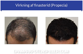Propecia effektivitet